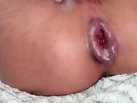 Young gay man worships a sexy prolapse